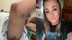 ‘My abusive ex-partner ran me over, leaving me on life support and with one leg, but I’m no longer afraid to speak out’