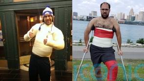 Man addicted to wearing orthopaedic casts turns hobby-turned-fetish into unique career selling sexual photos online