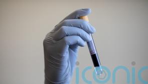 MPs defeat Government over moves to compensate infected blood scandal victims