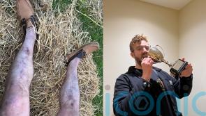 Man crowned shin kicking world champion on first try at the ancient sport aims for domination despite breaking two toes