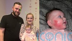 Mum who had sleepless nights to stop her baby scratching her sore and oozing skin due to eczema finds high street cure