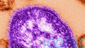 Nine suspected cases of measles in Ireland recorded in one week