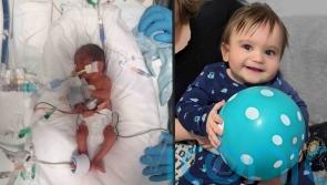 Baby born weighing just 1lb ‘doing brilliantly’ as he celebrates first birthday