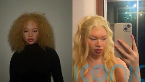 Albino woman picked on and fetishised in younger years now modelling at London Fashion Week and in Vogue Magazine