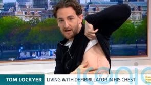 I call it my new little superpower – Tom Lockyer shows defibrillator scar