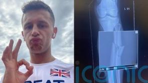 Long jumper’s Paris Olympic dream dashed after broken calf bone fails to heal in seven months instead of seven weeks