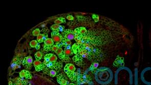 Fruit flies could help scientists stop the growth of brain tumours