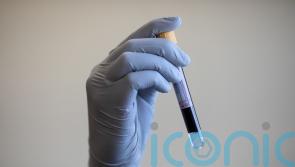 Blood test ‘could identify people at highest risk of dying from heart failure’