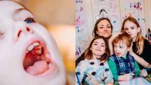 Frustrated mother waiting nearly two years for daughter’s ‘rotting’ tooth to be removed due to NHS waiting lists