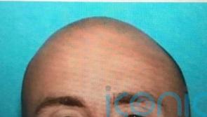 US police hunt for white supremacist prisoner after escape from hospital