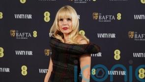 Paloma Faith reveals ‘stress-related alopecia’: Why does stress cause hair loss and what can you do about it?