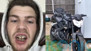 Rider swallows loose tooth after horrendous accident meant doctors had to wire his jaw shut to prevent face collapse