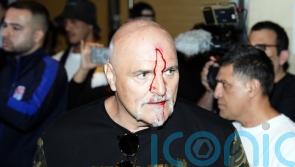 Tyson Fury’s father John suffers cut to head as Oleksandr Usyk fight week begins