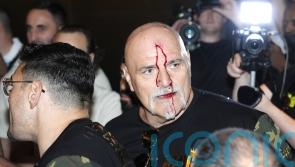 Tyson Fury’s father John cut after clash with member of Oleksandr Usyk entourage