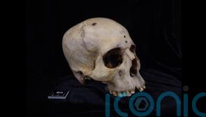 Ancient Egyptians ‘were trying to understand and treat cancer 4,000 years ago’