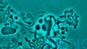 Full list of Greencore products recalled over E. coli fears