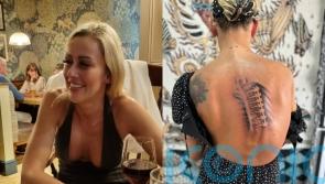 Fitness instructor with scoliosis raises £500 for tattoo of bolts in her collapsing spine to ‘stop the bullying’