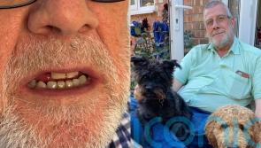 Dentist gives ex-paramedic £50,000 after root canal resulted in heart infection which may shorten his life by five years