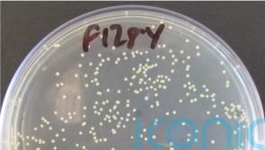 Scottish scientists to spend two years studying MRSA antibiotic resistance