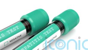 Investigation launched as hepatitis A discovered in North Lanarkshire