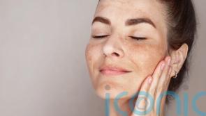 Why does the sun give me hyperpigmentation and what can I do about it?