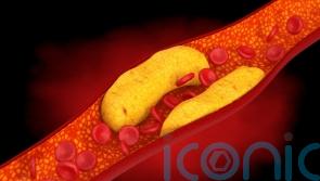 Consider lowering cholesterol ‘much earlier on in life’, researchers suggest