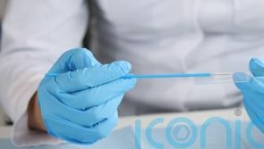 ‘Strong support’ for DIY cervical screening tests – poll