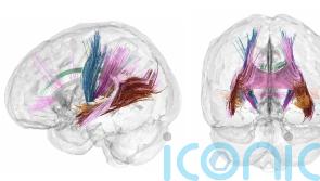 Scans show changes in brain during pregnancy