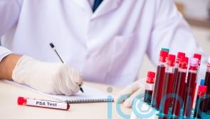 Charity calls for change to prostate cancer testing guidelines