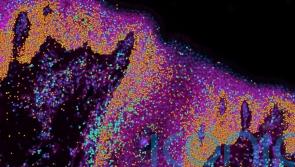 Human skin map gives ‘recipe’ to build skin and ‘could help prevent scarring’