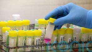 TB cases rose 40% in Scotland last year, figures show