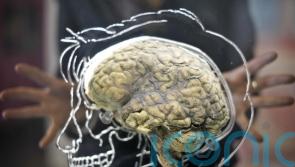 Poor sleep may age the brain by nearly three years, scientists say