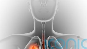 Lung Cancer Awareness Month: Can I get lung cancer if I’ve never smoked?  