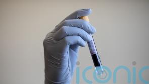 Blood test could ‘reliably rule out’ Alzheimer’s, trial finds