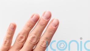 How to stop dry and cracked cuticles