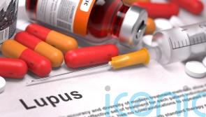 What is lupus and what are the symptoms?