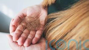 What is winter hair loss and how can you prevent it?