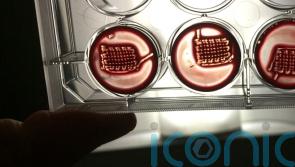 Patients’ own blood could be used to help repair broken bones, study suggests