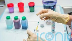 AI urine analysis predicts infection in lung disease patients a week in advance