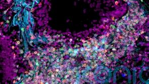 Researchers hit ‘major milestone’ in mapping cells of the human body