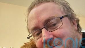 Assisted dying: Man with terminal brain condition says fix palliative care first
