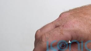 Public urged to learn ‘spiking first aid’ ahead of Christmas parties