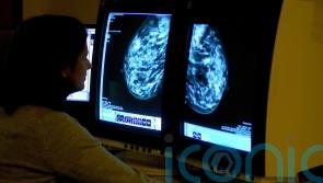 New blood test can spot breast cancer at earliest stages, say scientists