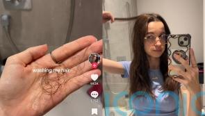 Trichotillomania sufferer shares methods to combat hair pulling disorder after millions watch her on TikTok