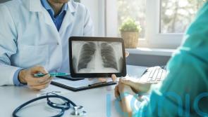 Make it easier for those with lung cancer symptoms to get tests, experts say