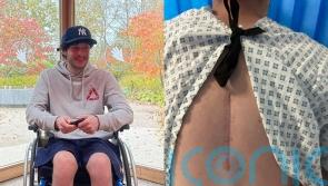 Fit young man, 27, whose legs suddenly felt ‘weak and wobbly’ now paralysed after surgery on rare spine abnormality