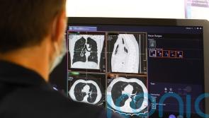 Early cancer diagnosis in England reaches highest level