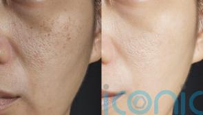 How to revive your skin post holiday indulgence