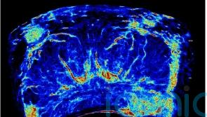 New prostate cancer imaging shows ‘extremely encouraging’ results in trials