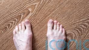 8 things your feet can tell you about your health